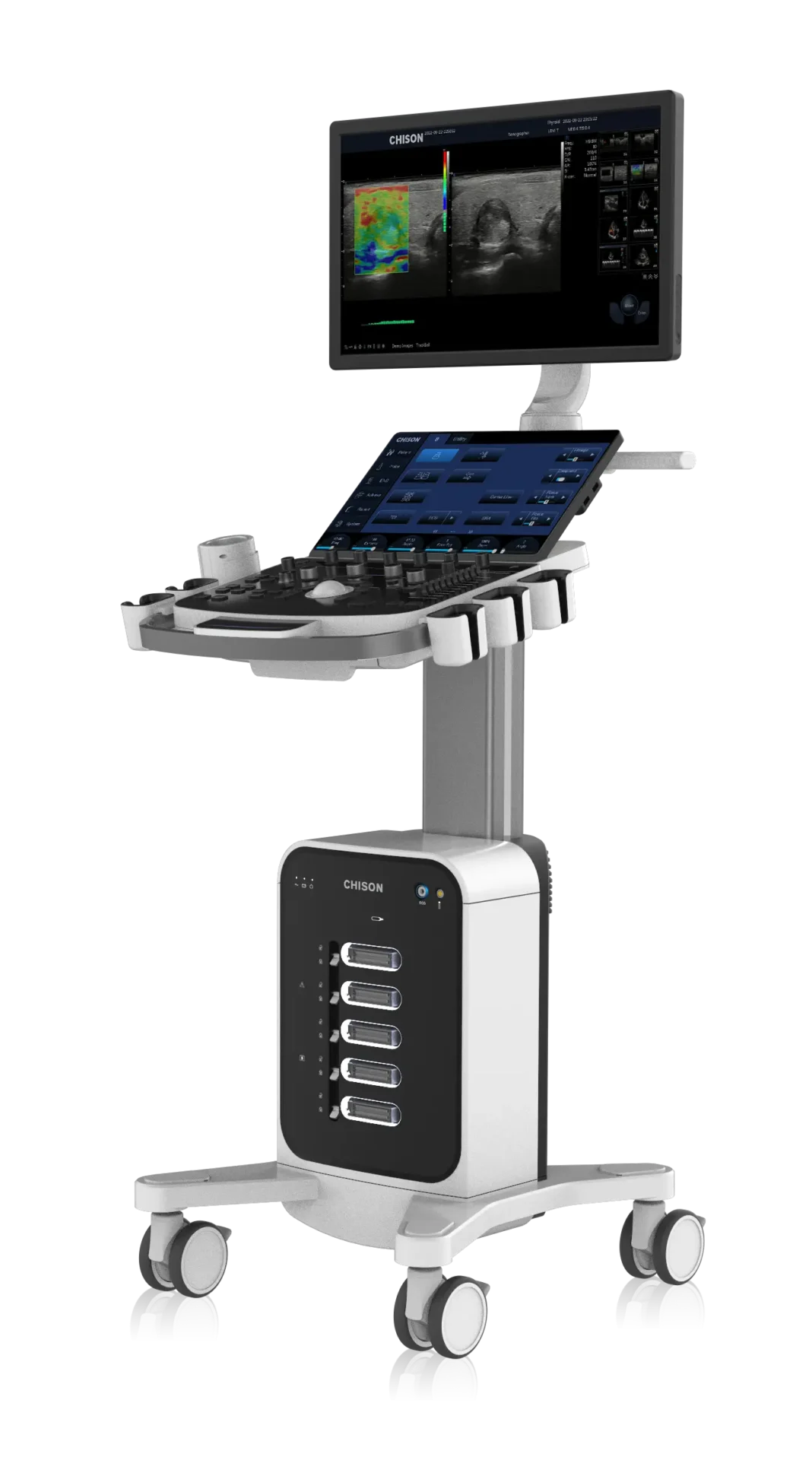 Cart-based Ultrasound..