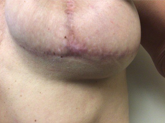 Picture7