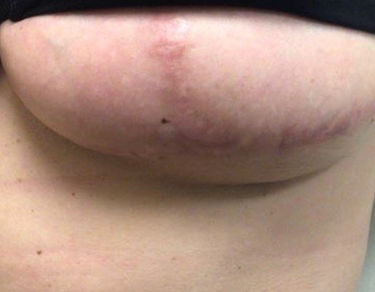 Picture8